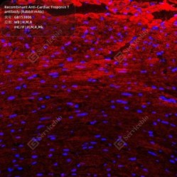Recombinant Anti-Cardiac Troponin T antibody (Rabbit mAb)