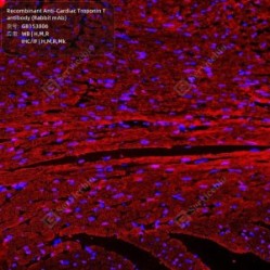 Recombinant Anti-Cardiac Troponin T antibody (Rabbit mAb)