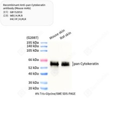 Recombinant Anti-pan Cytokeratin antibody (Mouse mAb)