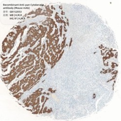 Recombinant Anti-pan Cytokeratin antibody (Mouse mAb)