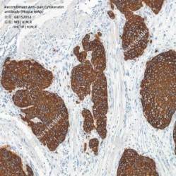 Recombinant Anti-pan Cytokeratin antibody (Mouse mAb)