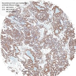 Recombinant Anti-pan Cytokeratin antibody (Mouse mAb)