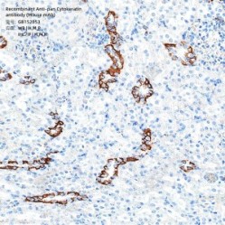 Recombinant Anti-pan Cytokeratin antibody (Mouse mAb)