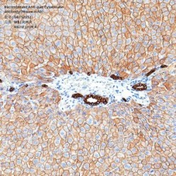 Recombinant Anti-pan Cytokeratin antibody (Mouse mAb)