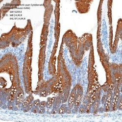 Recombinant Anti-pan Cytokeratin antibody (Mouse mAb)