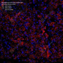 Recombinant Anti-pan Cytokeratin antibody (Mouse mAb)