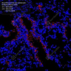 Recombinant Anti-pan Cytokeratin antibody (Mouse mAb)