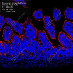 Recombinant Anti-pan Cytokeratin antibody (Mouse mAb)