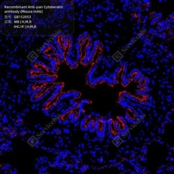 Recombinant Anti-pan Cytokeratin antibody (Mouse mAb)