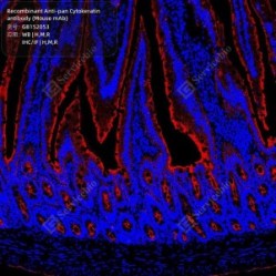 Recombinant Anti-pan Cytokeratin antibody (Mouse mAb)