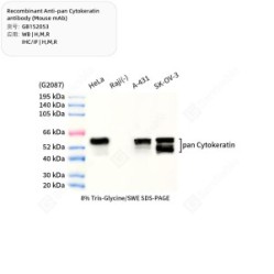 Recombinant Anti-pan Cytokeratin antibody (Mouse mAb)