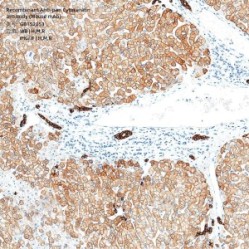 Recombinant Anti-pan Cytokeratin antibody (Mouse mAb)