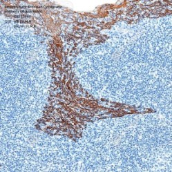 Recombinant Anti-pan Cytokeratin antibody (Mouse mAb)