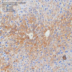 Recombinant Anti-pan Cytokeratin antibody (Mouse mAb)