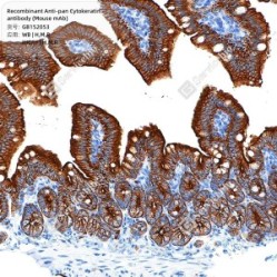 Recombinant Anti-pan Cytokeratin antibody (Mouse mAb)
