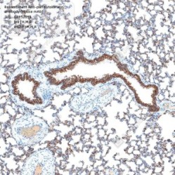 Recombinant Anti-pan Cytokeratin antibody (Mouse mAb)