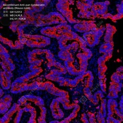 Recombinant Anti-pan Cytokeratin antibody (Mouse mAb)
