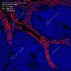 Recombinant Anti-pan Cytokeratin antibody (Mouse mAb)