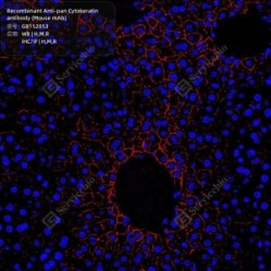 Recombinant Anti-pan Cytokeratin antibody (Mouse mAb)