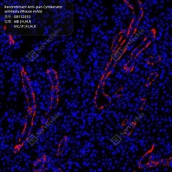 Recombinant Anti-pan Cytokeratin antibody (Mouse mAb)