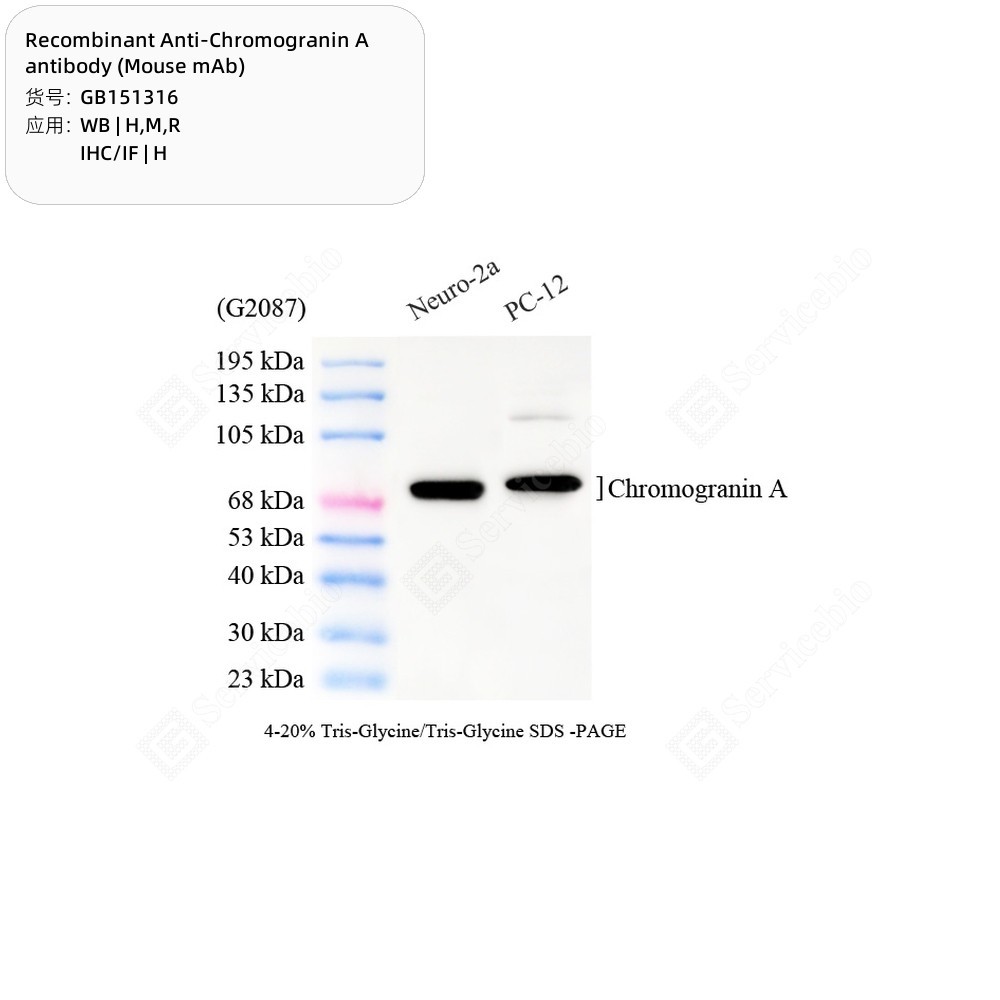 Recombinant Anti-Chromogranin A antibody (Mouse mAb)