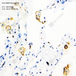 Anti-MMP9 Mouse mAb