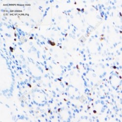 Anti-MMP9 Mouse mAb