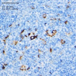 Anti-MMP9 Mouse mAb