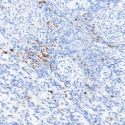 Anti-MMP9 Mouse mAb