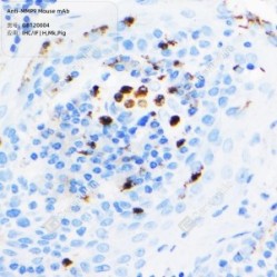 Anti-MMP9 Mouse mAb