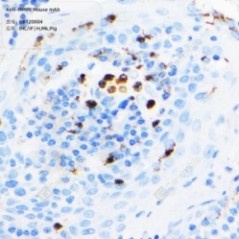 Anti-MMP9 Mouse mAb
