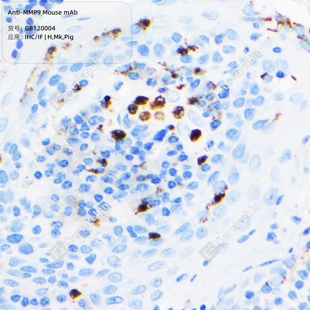 Anti-MMP9 Mouse mAb