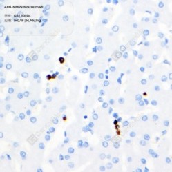 Anti-MMP9 Mouse mAb