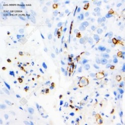 Anti-MMP9 Mouse mAb
