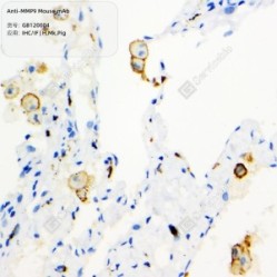 Anti-MMP9 Mouse mAb