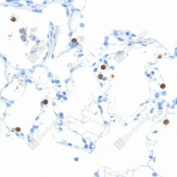 Anti-MMP9 Mouse mAb