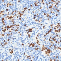 Anti-MMP9 Mouse mAb