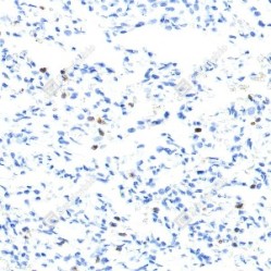 Anti-MMP9 Mouse mAb