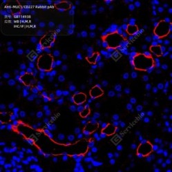 Anti-MUC1/CD227 Rabbit pAb