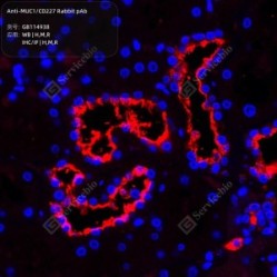 Anti-MUC1/CD227 Rabbit pAb
