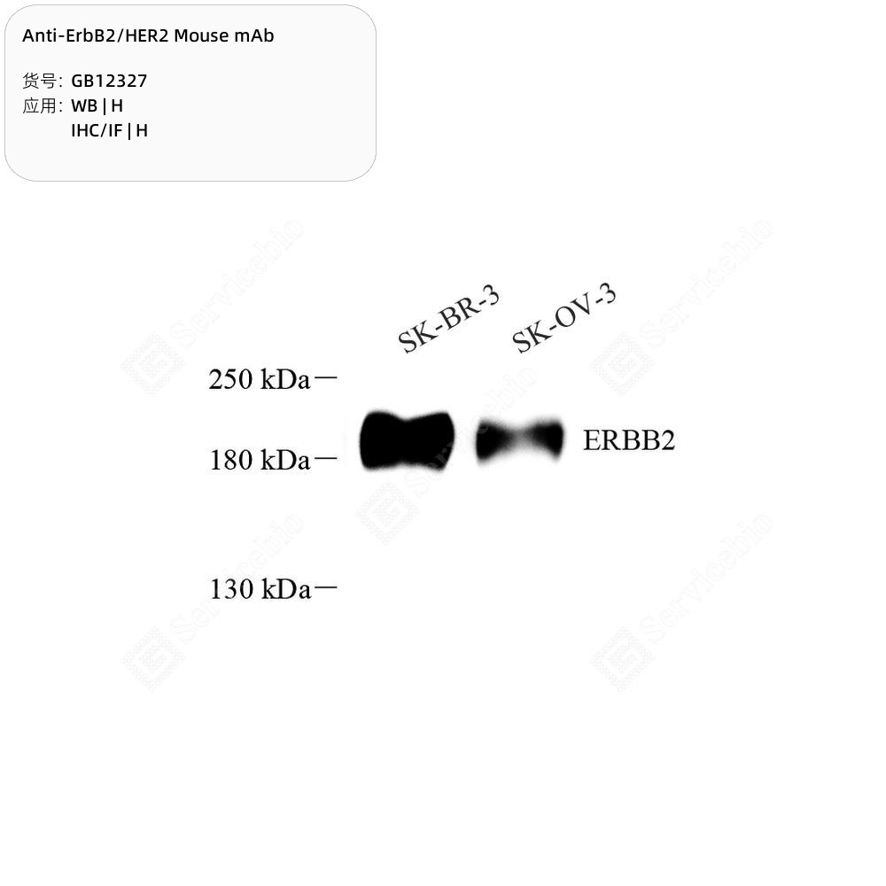 Anti-ErbB2/HER2 Rabbit pAb