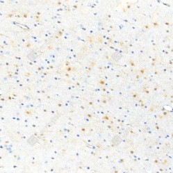 Anti-S100 beta Rabbit pAb
