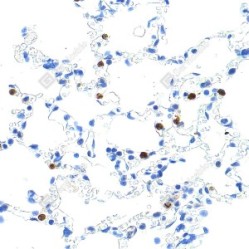 Anti-MMP9 Rabbit pAb