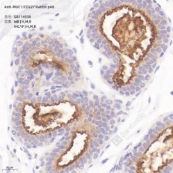 Anti-MUC1/CD227 Rabbit pAb