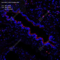 Anti-MUC1/CD227 Rabbit pAb