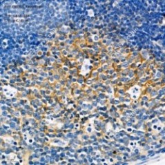Anti-ENTPD5 Rabbit pAb