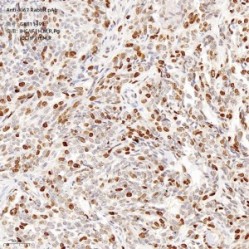 Anti-Ki67 Rabbit pAb