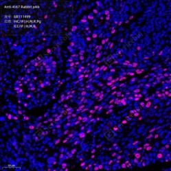 Anti-Ki67 Rabbit pAb