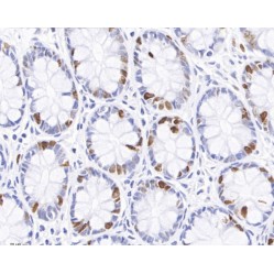 Anti-Ki67 Mouse mAb, Primary Antibody