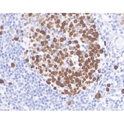 Anti-Ki67 Mouse mAb, Primary Antibody